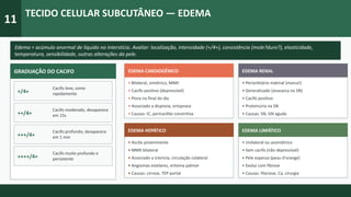 11
TECIDO CELULAR SUBCUTÂNEO — EDEMA
Edema = acúmulo anormal de líquido no interstício. Avaliar: localização, intensidade (+/4+), consistência (mole?duro?), elasticidade,
temperatura, sensibilidade, outras alterações da pele.
GRADUAÇÃO DO CACIFO
+/4+
Cacifo leve, some
rapidamente
++/4+
Cacifo moderado, desaparece
em 15s
+++/4+
Cacifo profundo, desaparece
em 1 min
++++/4+
Cacifo muito profundo e
persistente
EDEMA CARDIOGÊNICO
• Bilateral, simétrico, MMII
• Cacifo positivo (depressível)
• Piora no final do dia
• Associado a dispneia, ortopneia
• Causas: IC, pericardite constritiva
EDEMA RENAL
• Periorbitário matinal (marca!)
• Generalizado (anasarca na SN)
• Cacifo positivo
• Proteinúria na SN
• Causas: SN, GN aguda
EDEMA HEPÁTICO
• Ascite proeminente
• MMII bilateral
• Associado a icterícia, circulação colateral
• Angiomas estelares, eritema palmar
• Causas: cirrose, TEP portal
EDEMA LINFÁTICO
• Unilateral ou assimétrico
• Sem cacifo (não depressível)
• Pele espessa (peau d'orange)
• Evolui com fibrose
• Causas: filariose, Ca, cirurgia
 