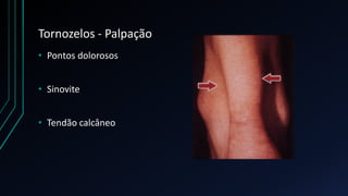 Tornozelos - Palpação
• Pontos dolorosos
• Sinovite
• Tendão calcâneo
 