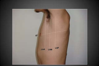 6º6º
LAALAA LAMLAM
LAPLAP
 