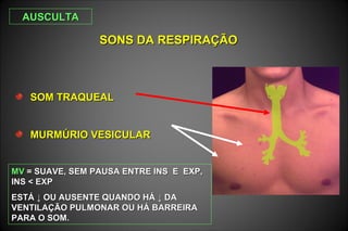 SOM TRAQUEALSOM TRAQUEAL
MURMÚRIO VESICULARMURMÚRIO VESICULAR
SONS DA RESPIRAÇÃOSONS DA RESPIRAÇÃO
MVMV = SUAVE, SEM PAUSA ENTRE INS E EXP,= SUAVE, SEM PAUSA ENTRE INS E EXP,
INS < EXPINS < EXP
ESTÁESTÁ ↓ OU AUSENTE QUANDO HÁ↓ OU AUSENTE QUANDO HÁ ↓ DA↓ DA
VENTILAÇÃO PULMONAR OU HÁ BARREIRAVENTILAÇÃO PULMONAR OU HÁ BARREIRA
PARA O SOM.PARA O SOM.
AUSCULTAAUSCULTA
 