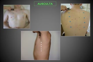 AUSCULTAAUSCULTA
 