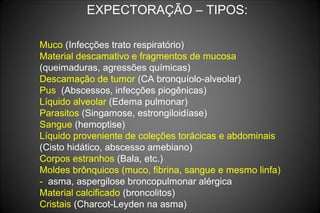 EXPECTORAÇÃO – TIPOS:
Muco (Infecções trato respiratório)
Material descamativo e fragmentos de mucosa
(queimaduras, agressões químicas)
Descamação de tumor (CA bronquíolo-alveolar)
Pus (Abscessos, infecções piogênicas)
Líquido alveolar (Edema pulmonar)
Parasitos (Singamose, estrongiloidíase)
Sangue (hemoptise)
Líquido proveniente de coleções torácicas e abdominais
(Cisto hidático, abscesso amebiano)
Corpos estranhos (Bala, etc.)
Moldes brônquicos (muco, fibrina, sangue e mesmo linfa)
- asma, aspergilose broncopulmonar alérgica
Material calcificado (broncolitos)
Cristais (Charcot-Leyden na asma)
 