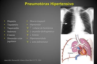 Pneumotórax HipertensivoPneumotórax Hipertensivo
• DispnéiaDispnéia
• TaquipnéiaTaquipnéia
• TaquicardiaTaquicardia
• SudoreseSudorese
• CianoseCianose
• Distensão veiasDistensão veias
jugularesjugulares
• Desvio traquealDesvio traqueal
• HipotensãoHipotensão
∀ ↑↑ volume do hemitóraxvolume do hemitórax
∀ ↓↓ excursão diafragmáticaexcursão diafragmática
∀ ↓↓ frêmitofrêmito
• HipersonoridadeHipersonoridade
∀ ↓↓ sons pulmonaressons pulmonares
Jantz MA, Pierson DJ. Clinics Chest Med 15:75; 1994Jantz MA, Pierson DJ. Clinics Chest Med 15:75; 1994
 