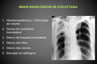 SINAIS RADIOLÓGICOS DE ATELECTASIA
1. Hipotransparência c / diminuição
de volume
2. Desvio do mediastino
homolateral
3. Desvio da traquéia homolateral
4. Desvio dos hilos
5. Desvio das cisuras
6. Elevação do diafragma
 