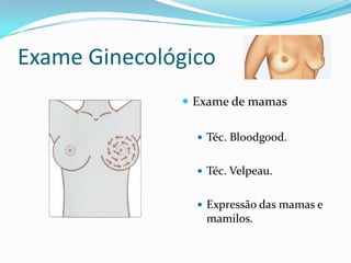 Exame Ginecológico
 Exame de mamas
 Téc. Bloodgood.
 Téc. Velpeau.
 Expressão das mamas e

mamilos.

 