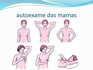 autoexame das mamas

 