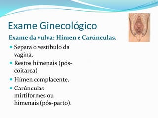 Exame Ginecológico
Exame da vulva: Hímen e Carúnculas.
 Separa o vestíbulo da
vagina.
 Restos himenais (póscoitarca)
 Hímen complacente.
 Carúnculas

mirtiformes ou
himenais (pós-parto).

 
