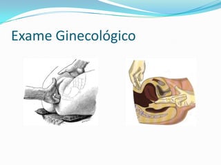 Exame Ginecológico

 