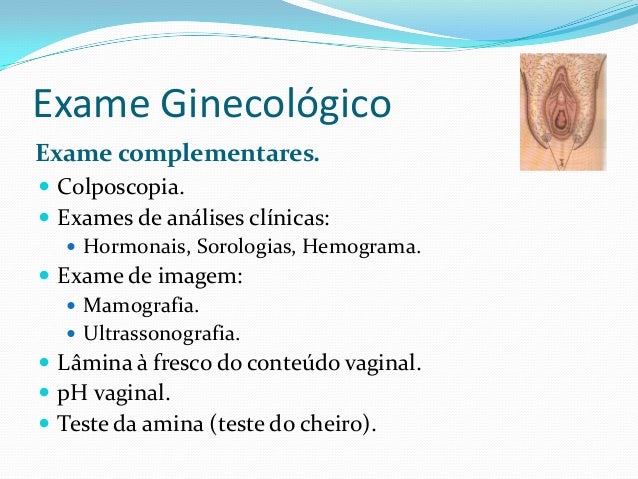 Exame ginecológico Exame ginecológico