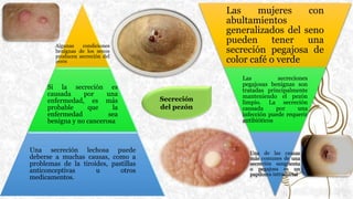 Secreción
del pezón
Algunas condiciones
benignas de los senos
producen secreción del
pezón
Si la secreción es
causada por una
enfermedad, es más
probable que la
enfermedad sea
benigna y no cancerosa
Una secreción lechosa puede
deberse a muchas causas, como a
problemas de la tiroides, pastillas
anticonceptivas u otros
medicamentos.
Las mujeres con
abultamientos
generalizados del seno
pueden tener una
secreción pegajosa de
color café o verde
Las secreciones
pegajosas benignas son
tratadas principalmente
manteniendo el pezón
limpio. La secreción
causada por una
infección puede requerir
antibióticos
Una de las causas
más comunes de una
secreción sangrienta
o pegajosa es un
papiloma intraductal
 