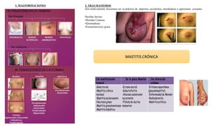 1. MALFORMACIONES 2. TRAUMATISMOS
Son relativamente frecuentes en: la práctica de deportes, accidentes, mordeduras y agresiones sexuales.
Heridas Incisas
•Heridas Contusa
•Quemaduras
•Esteatonecrosis grasa
MASTITIS CRÓNICA
 