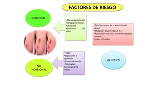 FACTORES DE RIESGO
HORMONAL
GENETICO
NO
HORMONAL
•Menopausia tardía
•Terapia hormonal
•Obesidad
•Embarazo >30
años
• Edad
•Exposición a
radiación
•Cáncer de ovario
•Patologías
benignas de la
mama
•Edad temprana de la aparición del
cáncer
•Mutación de gen BRCA 1 Y 2
•Asociación con otros tumores malignos
: Ovario
•colon y Tiroides
 