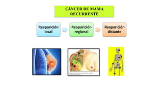 CÁNCER DE MAMA
RECURRENTE
Reaparición
local
Reaparición
regional
Reaparición
distante
 