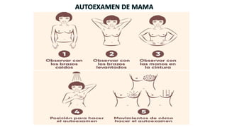 AUTOEXAMEN DE MAMA
 
