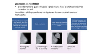 ¿Cuáles son los resultados?
• El tejido mamario que no muestra signos de una masa o calcificaciones se
considera normal.
Un médico radiólogo puede ver los siguientes tipos de resultados en una
mamografía:
Una mancha clara, regular
y bien definida (esto muy
probablemente es una
afección NO cancerosa
como un quiste)
Masas o tumores
Zonas densas en el pecho
que pueden ser cáncer de
mama
Calcificaciones, que son
causadas por depósitos
diminutos de calcio en el
tejido mamario (la mayor
parte de las calcificaciones
no son un signo de cáncer)
 