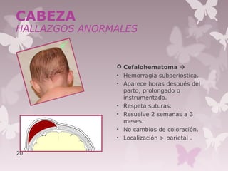  Cefalohematoma 
• Hemorragia subperióstica.
• Aparece horas después del
parto, prolongado o
instrumentado.
• Respeta suturas.
• Resuelve 2 semanas a 3
meses.
• No cambios de coloración.
• Localización > parietal .
20
CABEZA
HALLAZGOS ANORMALES
 