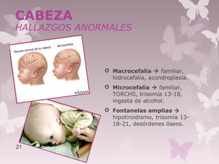  Macrocefalia  familiar,
hidrocefalia, acondroplasia.
 Microcefalia  familiar,
TORCHS, trisomía 13-18,
ingesta de alcohol.
 Fontanelas amplias 
hipotiroidismo, trisomía 13-
18-21, desórdenes óseos.
21
CABEZA
HALLAZGOS ANORMALES
 