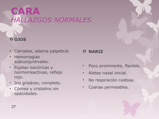  OJOS
• Cerrados, edema palpebral.
• Hemorragias
subconjuntivales.
• Pupilas isocóricas y
normorreactivas, reflejo
rojo.
• Iris grisáceo, completo.
• Córnea y cristalino sin
opacidades.
 NARIZ
• Poco prominente, flexible.
• Aleteo nasal inicial.
• No respiración ruidosa.
• Coanas permeables.
27
CARA
HALLAZGOS NORMALES
 