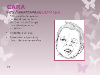  PARÁLISIS FACIAL
• Compresión del nervio
contra el promontorio
sacro o uso de fórceps
durante el período
expulsivo.
• Evidente 1-2º día.
• Resolución espontánea
días, total semanas-años.
29
CARA
HALLAZGOS ANORMALES
 