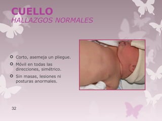  Corto, asemeja un pliegue.
 Móvil en todas las
direcciones, simétrico.
 Sin masas, lesiones ni
posturas anormales.
32
CUELLO
HALLAZGOS NORMALES
 