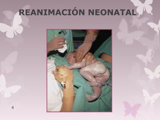 REANIMACIÓN NEONATAL
4
 