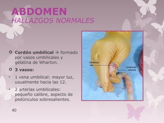  Cordón umbilical  formado
por vasos umbilicales y
gelatina de Wharton.
 3 vasos:
• 1 vena umbilical: mayor luz,
usualmente hacia las 12.
• 2 arterias umbilicales:
pequeño calibre, aspecto de
pedúnculos sobresalientes.
40
ABDOMEN
HALLAZGOS NORMALES
 