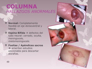  Normal: Completamente
flexible en eje dorsoventral y
lateral.
 Espina Bífida  defectos del
tubo neural: cerrado, oculta,
meningocele,
mielomeningocele.
 Fositas / Apéndices sacros
 ameritan estudios
adicionales para descartar
disrafias.
49
COLUMNA
HALLAZGOS ANORMALES
 