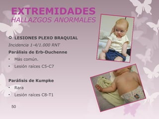  LESIONES PLEXO BRAQUIAL
Incidencia 1-4/1.000 RNT
Parálisis de Erb-Duchenne
• Más común.
• Lesión raíces C5-C7
Parálisis de Kumpke
• Rara
• Lesión raíces C8-T1
50
EXTREMIDADES
HALLAZGOS ANORMALES
 