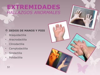  DEDOS DE MANOS Y PIES
• Braquidactilia
• Aracnodactilia
• Clinodactilia
• Camptodactilia
• Sindactilia
• Polidactilia
51
EXTREMIDADES
HALLAZGOS ANORMALES
 