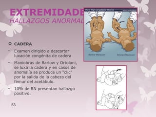  CADERA
• Examen dirigido a descartar
luxación congénita de cadera
• Maniobras de Barlow y Ortolani,
se luxa la cadera y en casos de
anomalía se produce un “clic”
por la salida de la cabeza del
fémur del acetábulo.
• 10% de RN presentan hallazgo
positivo.
53
EXTREMIDADES
HALLAZGOS ANORMALES
 