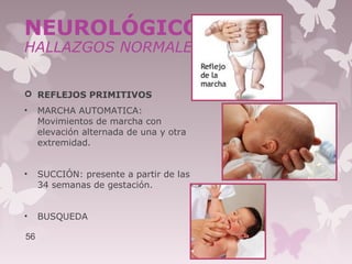  REFLEJOS PRIMITIVOS
• MARCHA AUTOMATICA:
Movimientos de marcha con
elevación alternada de una y otra
extremidad.
• SUCCIÓN: presente a partir de las
34 semanas de gestación.
• BUSQUEDA
56
NEUROLÓGICO
HALLAZGOS NORMALES
 