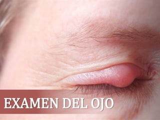 EXAMEN DEL OJO
 