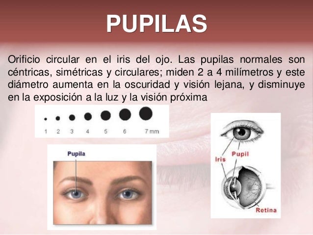 Examen de Ojo