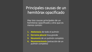 Principales causas de un
hemitórax opacificado
Hay tres causas principales de un
hemitórax opacificado y otra que es
menos común:
1. Atelectasia de todo el pulmón
2. Derrame pleural muy grande
3. Neumonía de un pulmón completo
4. Neumonectomía (extracción de un
pulmón completo)
 