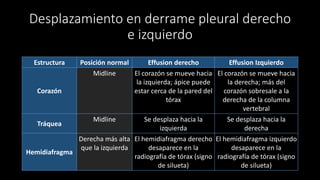 Desplazamiento en derrame pleural derecho
e izquierdo
Estructura Posición normal Effusion derecho Effusion Izquierdo
Corazón
Midline El corazón se mueve hacia
la izquierda; ápice puede
estar cerca de la pared del
tórax
El corazón se mueve hacia
la derecha; más del
corazón sobresale a la
derecha de la columna
vertebral
Tráquea
Midline Se desplaza hacia la
izquierda
Se desplaza hacia la
derecha
Hemidiafragma
Derecha más alta
que la izquierda
El hemidiafragma derecho
desaparece en la
radiografía de tórax (signo
de silueta)
El hemidiafragma izquierdo
desaparece en la
radiografía de tórax (signo
de silueta)
 