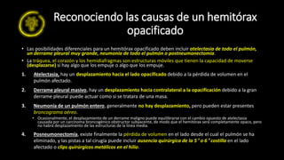 Reconociendo las causas de un hemitórax
opacificado
• Las posibilidades diferenciales para un hemitórax opacificado deben incluir atelectasia de todo el pulmón,
un derrame pleural muy grande, neumonía de todo el pulmón o postneumonectomía.
• La tráquea, el corazón y los hemidiafragmas son estructuras móviles que tienen la capacidad de moverse
(desplazarse) si hay algo que los empuje o algo que los empuje.
1. Atelectasia, hay un desplazamiento hacia el lado opacificado debido a la pérdida de volumen en el
pulmón afectado.
2. Derrame pleural masivo, hay un desplazamiento hacia contralateral a la opacificación debido a la gran
derrame pleural puede actuar como si se tratara de una masa.
3. Neumonía de un pulmón entero, generalmente no hay desplazamiento, pero pueden estar presentes
broncograma aéreo.
• Ocasionalmente, el desplazamiento de un derrame maligno puede equilibrarse con el cambio opuesto de atelectasia
causada por un carcinoma broncogénico obstructor subyacente, de modo que el hemitórax será completamente opaco, pero
no habrá desplazamiento de las estructuras de la línea media.
4. Posneumonectomía, existe finalmente la pérdida de volumen en el lado desde el cual el pulmón se ha
eliminado, y las pistas a tal cirugía puede incluir ausencia quirúrgica de la 5 º o 6 º costilla en el lado
afectado o clips quirúrgicos metálicos en el hilio.
 