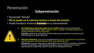 Penetración
Subpenetración
• Demasiado “blanda”
• NO se puede ver la columna torácica a través del corazón.
• Puede introducir al menos 2 errores en su interpretación:
1. Hemidiafragma izquierdo puede no ser visible porque la base del pulmón
izquierdo puede parecer opaca. Podría imitar u ocultar una enfermedad en el
campo pulmonar inferior izquierdo.
Solución: observe la radiografía de tórax lateral para confirmar la presencia de
enfermedad en la base izquierda
2. Marcas pulmonares, que son principalmente los vasos sanguíneos en el pulmón,
pueden parecer más prominentes de lo que realmente son.
Soluciones: busque otros signos radiológicos de insuficiencia cardíaca congestiva,
marcas aumentadas, enfermedad del espacio aéreo o derrame en la base
izquierda que sospechaba sobre la base de la radiografía frontal.
 