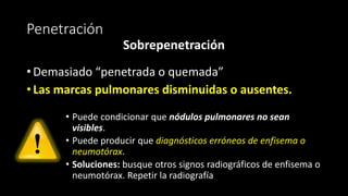 Penetración
Sobrepenetración
• Demasiado “penetrada o quemada”
• Las marcas pulmonares disminuidas o ausentes.
• Puede condicionar que nódulos pulmonares no sean
visibles.
• Puede producir que diagnósticos erróneos de enfisema o
neumotórax.
• Soluciones: busque otros signos radiográficos de enfisema o
neumotórax. Repetir la radiografía
 