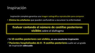 Inspiración
Inspiración completa garantiza una imagen radiográfica reproducible para comparar
• Elimina los artefactos que pueden confundirse u oscurecer la enfermedad.
Evaluar contando el número de costillas posteriores
visibles sobre el diafragma
✓Si 10 costillas posteriores son visibles, es una excelente inspiración
✓Pacientes hospitalizados de 8 - 9 costillas posteriores suele ser un grado
de inspiración adecuado
 