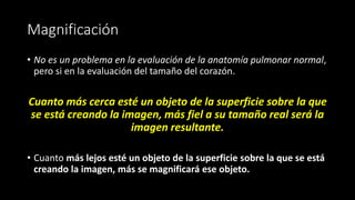 Magnificación
• No es un problema en la evaluación de la anatomía pulmonar normal,
pero si en la evaluación del tamaño del corazón.
Cuanto más cerca esté un objeto de la superficie sobre la que
se está creando la imagen, más fiel a su tamaño real será la
imagen resultante.
• Cuanto más lejos esté un objeto de la superficie sobre la que se está
creando la imagen, más se magnificará ese objeto.
 