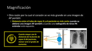 Magnificación
• Otra razón por la cual el corazón se ve más grande en una imagen de
AP portátil.
• Distancia entre el tubo de rayos X y el paciente es más corta cuando se
obtiene una imagen AP portátil y cuando una radiografía de tórax PA
estándar está expuesto.
Cuanto mayor sea la
distancia de la fuente de
rayos X del paciente,
menor será el grado de
aumento.
 