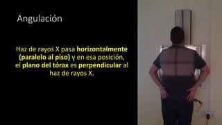 Haz de rayos X pasa horizontalmente
(paralelo al piso) y en esa posición,
el plano del tórax es perpendicular al
haz de rayos X.
Angulación
 