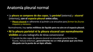 Anatomía pleural normal
• La pleura se compone de dos capas, la parietal (externa) y visceral
(internas), con el espacio pleural entre ellas.
• Pleura visceral es adherente al pulmón y se envuelve para formar las fisuras
mayores y menores.
Normalmente, hay varios mililitros de líquido pero no aire en el espacio pleural.
• Ni la pleura parietal ni la pleura visceral son normalmente
visibles en una radiografía de tórax convencional
• Cuando las dos capas de pleura visceral se envuelven para formar las
fisuras. Incluso entonces, generalmente no son más gruesas que una línea
dibujada con la punta de un lápiz afilado.
 
