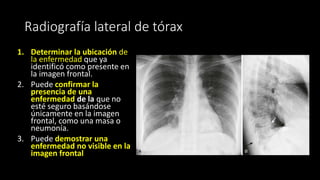 Radiografía lateral de tórax
1. Determinar la ubicación de
la enfermedad que ya
identificó como presente en
la imagen frontal.
2. Puede confirmar la
presencia de una
enfermedad de la que no
esté seguro basándose
únicamente en la imagen
frontal, como una masa o
neumonía.
3. Puede demostrar una
enfermedad no visible en la
imagen frontal
 