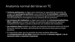 Anatomía normal del tórax en TC
• Ventanas pulmonares se eligen para maximizar la capacidad de anomalías de
imagen del parénquima pulmonar y para identificar la normalidad y anatomía
bronquial anormal. Las estructuras mediastínicas generalmente aparecen como
una densidad blanca homogénea en las ventanas de los pulmones.
• Las ventanas del mediastino se eligen para mostrar las estructurasmediastínica,
hiliar y pleural para la mejor ventaja. Los pulmones generalmente aparecen
completamente negros cuando se observan con ventanas del mediastino.
• Las ventanas óseas también se utilizan con bastante frecuencia como una tercera
forma de mostrar los datos, demostrando las estructuras óseas para su mejor
beneficio.
• Es importante saber que las pantallas de estas ventanas diferentes
sonmanipulaciones de los datos obtenidos durante el escaneo original. y no es
necesario volver a examinar al paciente .
 