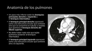 Anatomía de los pulmones
• Un poco más inferior están los bronquios
principales derecho e izquierdo y
el bronquio intermedius.
• El bronquio principal derecho aparecerá
como una estructura circular que contiene
aire que se convertirá en tubular a medida
que aparezca el bronquio derecho del
lóbulo superior.
• No debe haber nada más que tejido
pulmonar posterior al bronquio
intermedius
• El bronquio principal izquierdo aparecerá
como una estructura circular que contiene
aire a la izquierda.
 