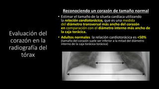 Evaluación del
corazón en la
radiografía del
tórax
Reconociendo un corazón de tamaño normal
• Estimar el tamaño de la silueta cardíaca utilizando
la relación cardiotorácica, que es una medida
del diámetro transversal más ancho del corazón
en comparación con el diámetro interno más ancho de
la caja torácica.
• Adultos normales la relación cardiotorácica es <50%
(tamaño del corazón suele ser inferior a la mitad del diámetro
interno de la caja torácica torácica)
 