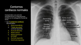 Contornos
cardiacos normales
Comprenden una serie de
protuberancias e indentaciones
visibles en la radiografía frontal de
tórax.
• Son 7 contornos cardiacos
identificables.
1. Aorta ascendente
2. “Doble densidad”
aurícula izquierda
3. Aurícula derecha
4. Botón aórtico
5. Arteria pulmonar
principal
6. Aurícula izquierda
7. Ventrículo izquierdo
 