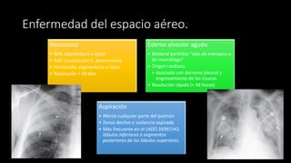 Enfermedad del espacio aéreo.
Neumonía
• 90% segmentaria o lobar
• NAC causada por S. pneumoniae
• Parcheado, segmentario o lobar
• Resolución < 10 días
Edema alveolar agudo
• Bilateral perihiliar “alas de mariposa o
de murciélago”
• Origen cardiaco.
• Asociado con derrame pleural y
engrosamiento de las cisuras.
• Resolución rápida (< 48 horas)
Aspiración
• Afecta cualquier parte del pulmón
• Zonas declive y sustancia aspirada
• Más frecuente en el LADO DERECHO,
lóbulos inferiores o segmentos
posteriores de los lóbulos superiores.
 