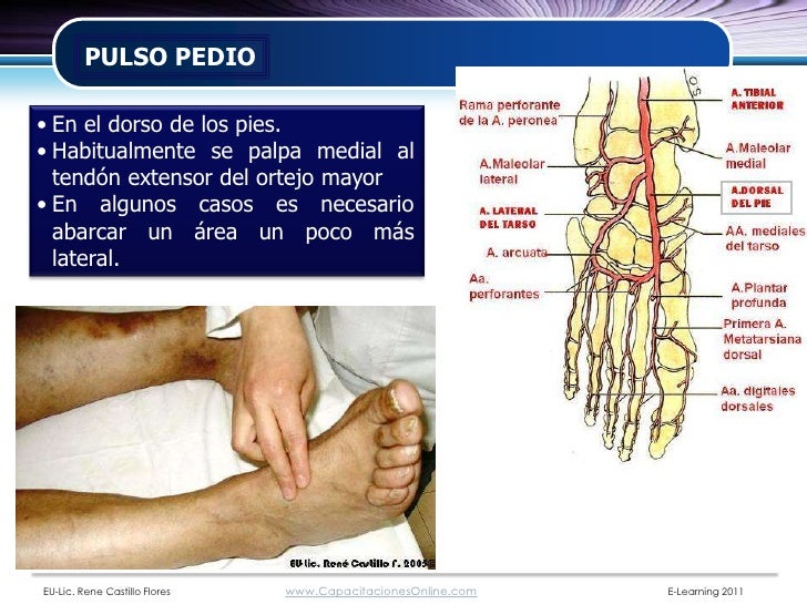 Examenclinicodelpiediabetico2008 110308132350phpapp01